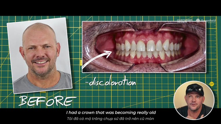 Natural, Not Hollywood — Morgan's Smile at Greenfield Dental